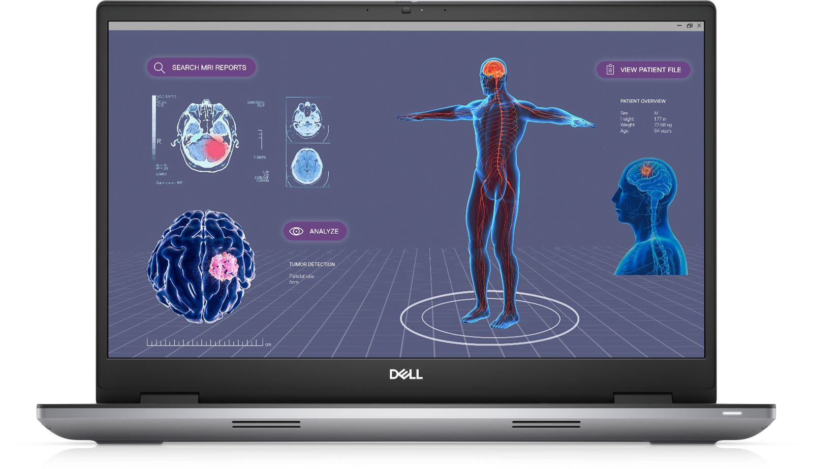 MOBILE PRECISION 7780/I7-13850HX/32/1TB/17/RTX3500 [IMAGE 1]